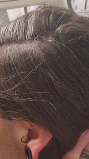 Horrible flakes, looks like I have awful dandruff after just one use! Awful product, waste of my money